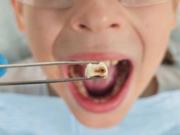 Best Emergency Dental Care for Sports Injuries in Cheverly, MD